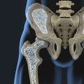 What happens to your bones when you get adjusted?