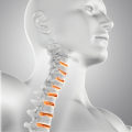 How do you know if your neck vertebrae is out of place?
