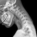 Can chiropractors diagnose xrays?