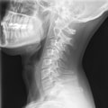 Do chiropractic adjustments actually move bones?