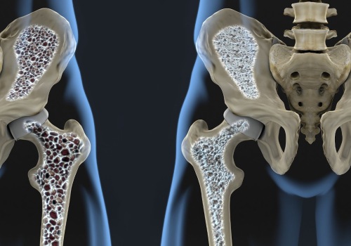 What happens to your bones when you get adjusted?