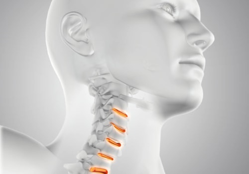 How do you know if your neck vertebrae is out of place?