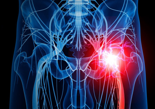 Can nerve pain get worse after chiropractor?