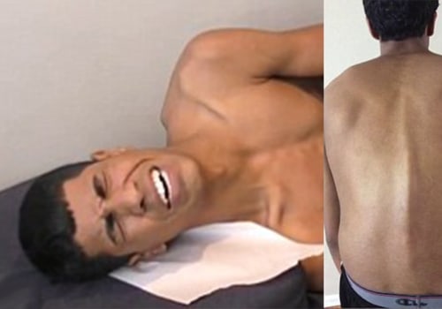 Are chiropractor results permanent?