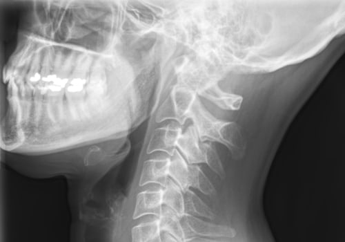 Do chiropractic adjustments actually move bones?